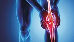 چگونه از دردهای مفصلی پیشگیری کنیم؟
